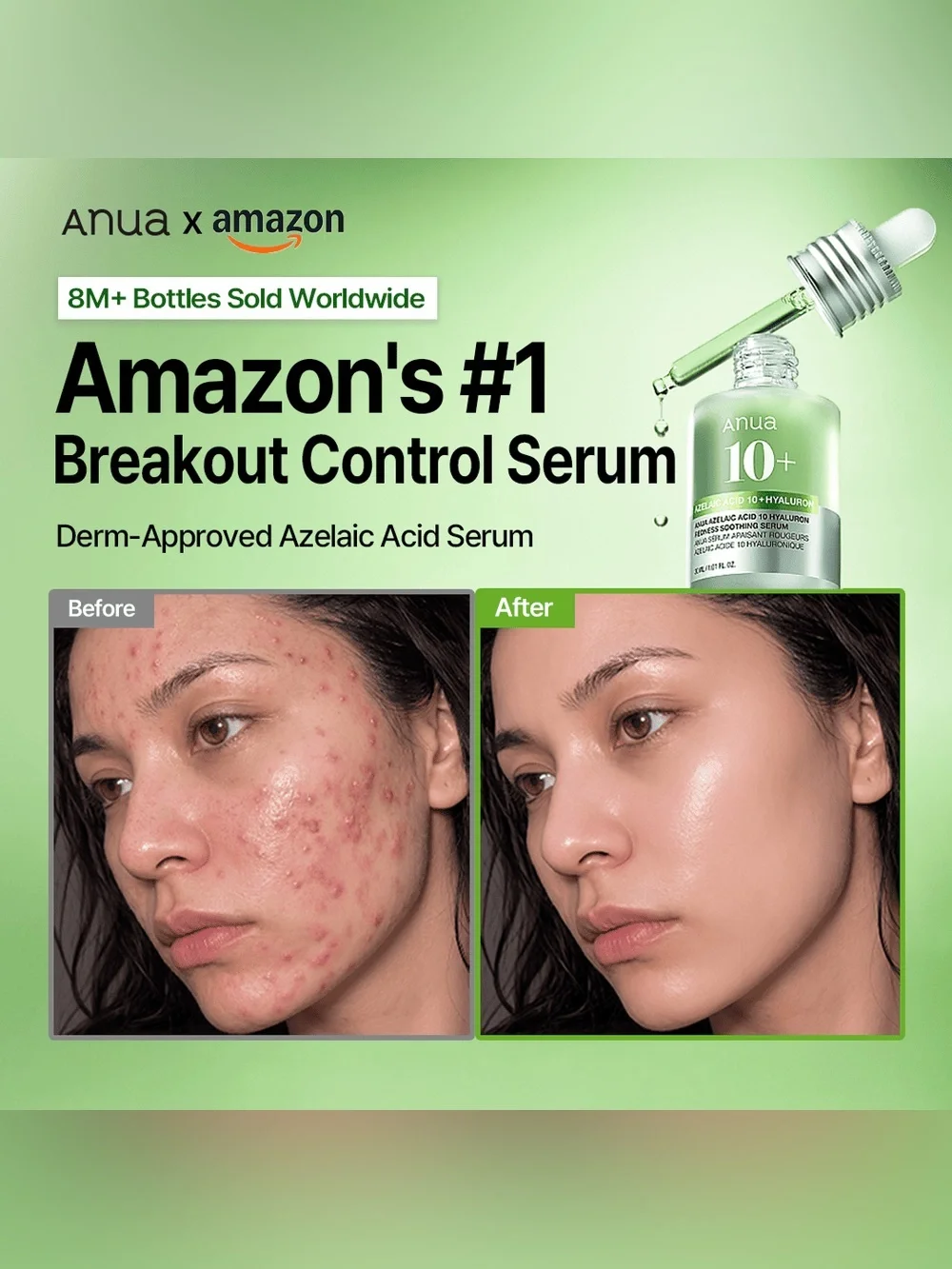 ✨NIB ✨ Anua Azelaic Acid 10 Hyaluron Redness Soothing Serum